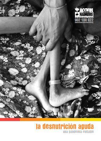 La desnutrición aguda: Una pandemia evitable